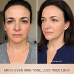 Intensive Peptide Serum with Golden Threads for an Instant Effect